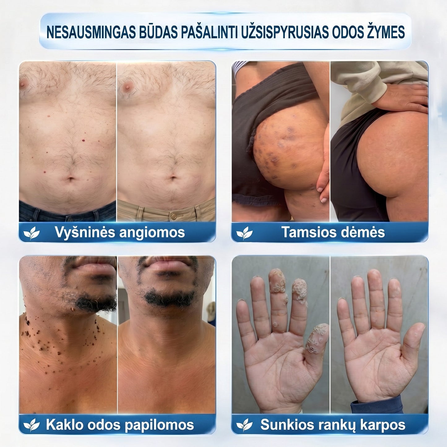 🍀👑𝐏i𝐜𝐝o® 𝟕 𝐃𝐢𝐞𝐧𝐨𝐬 𝐏𝐢𝐠𝐦𝐞𝐧𝐭𝐢𝐧𝐢ų 𝐃ė𝐦𝐢ų 𝐈𝐫 𝐑𝐚𝐧𝐝ų Š𝐚𝐥𝐢𝐧𝐢𝐦𝐚𝐬 𝐑𝐚š𝐢𝐤𝐥𝐢𝐬(𝐵𝑒 𝑠𝑘𝑎𝑢𝑠𝑚𝑜, 𝑏𝑒 𝑟𝑎𝑛𝑑ų – 𝑟𝑢𝑡𝑢𝑙𝑖𝑛𝑖𝑠 𝑎𝑝𝑙𝑖𝑘𝑎𝑡𝑜𝑟𝑖𝑢𝑠)💪